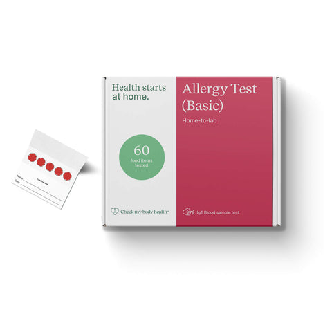 Allergy Test (Basic)