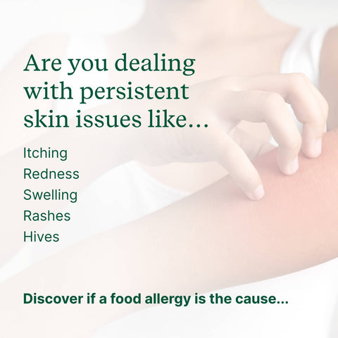 Skin Allergy Test Kit